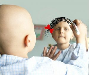 Cancer Diagnosis