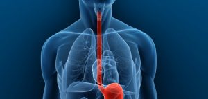 Esophageal Cancer