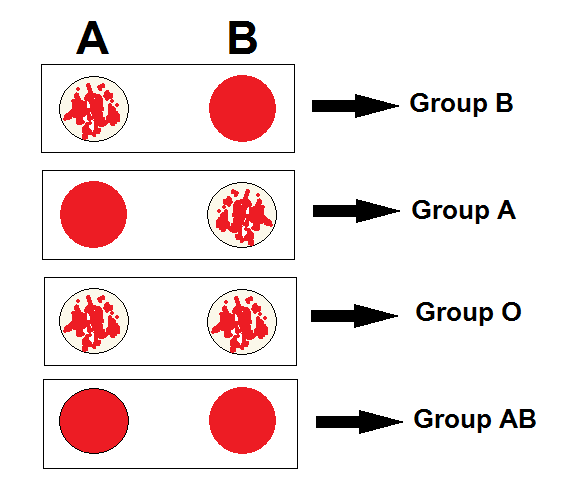 blood-typing-abo-zenonco-io