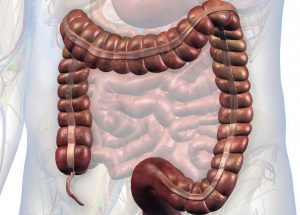 appendix cancer types