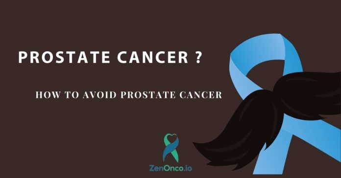 How to Avoid Prostate Cancer - ZenOnco.io