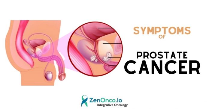 Symptoms of Prostate Cancer - ZenOnco.io