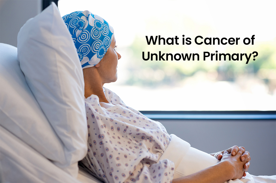What is Cancer of Unknown Primary