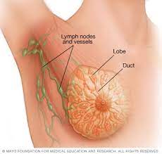 Treatments for Breast Cancer