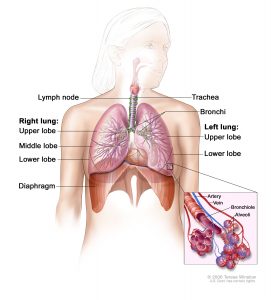 Introduction of Non-small cell Lung Cancer