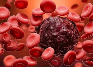 Blood Cancer And Its Complications