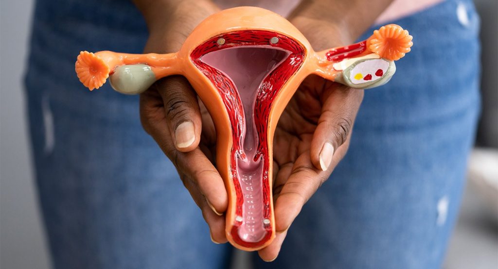 Soins de suivi du cancer de l'ovaire