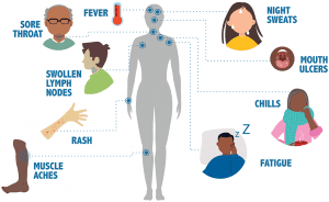 Signs and Symptoms of HIV Associated Cancer