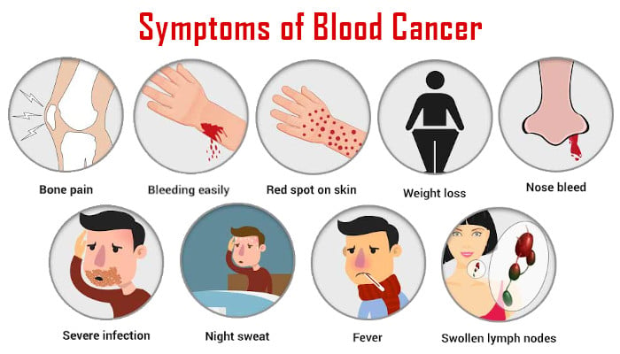 Quels sont les signes du cancer du sang ?