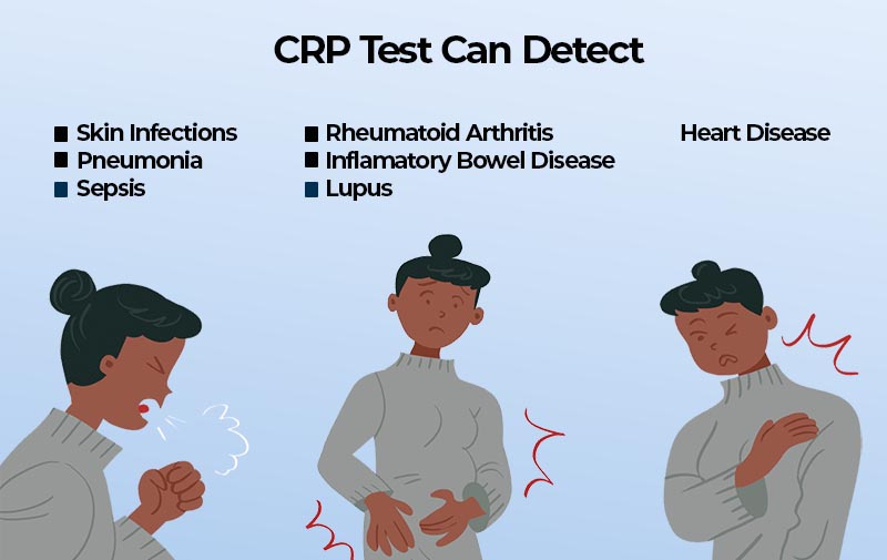 Reason For Crp Level High